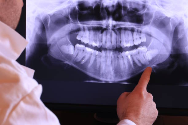 Best Knocked-Out Tooth Emergency  in Crookston, MN