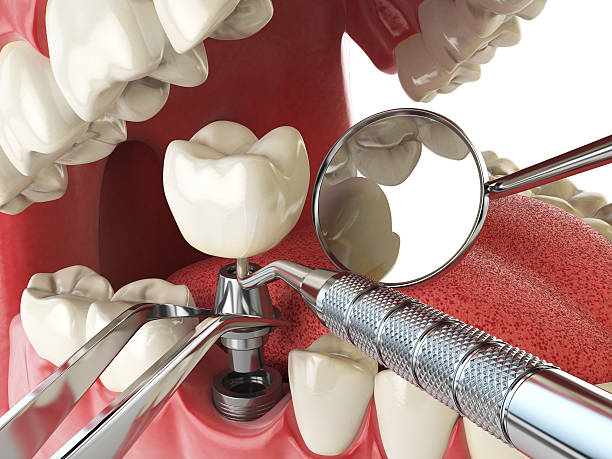 Best Tooth Infection Emergency Dentist  in Crookston, MN